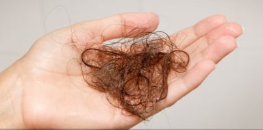 hair loss causes